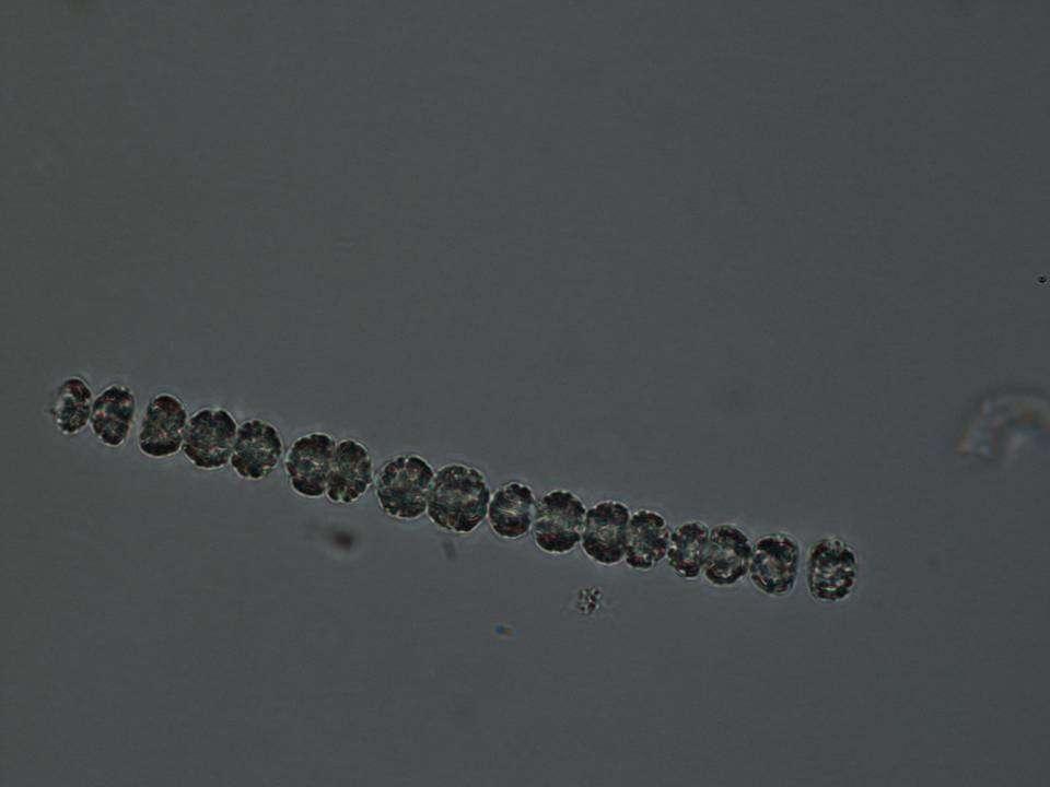 Anabaena