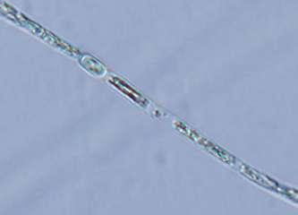 Trichome width