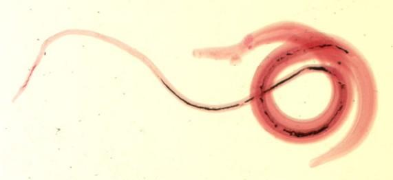 Schistosoma haematobium ttp://www.infovek.