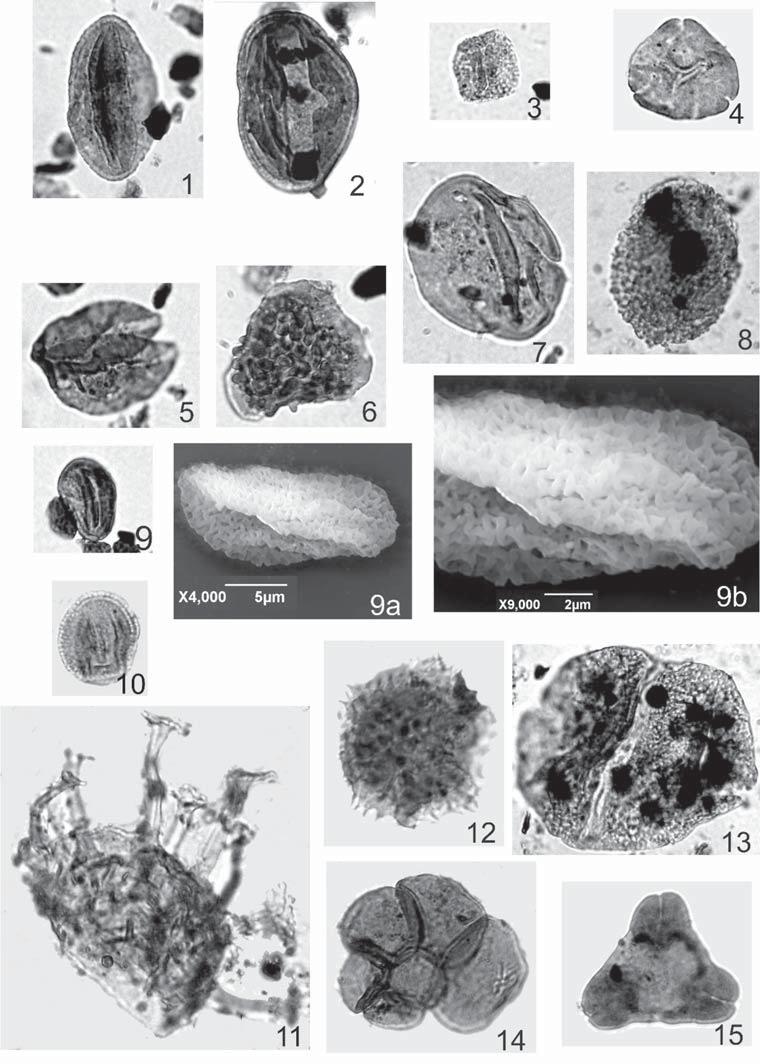 Obr. 2: Základní typy pylových zrn a spor z vrtu Iváň IK-1 u Hustopečí (zvětšení LM 1000 ). Fig.