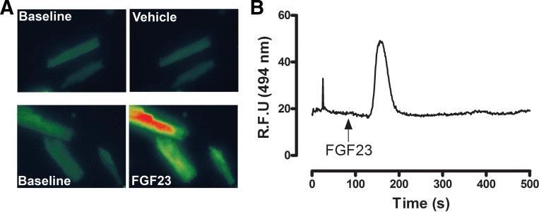 vliv podání FGF23 na obsah kalcia v kardiomyocytech Ch.