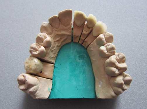 více vrstvách: Deep Dentin (č. 3), Dentin (č.