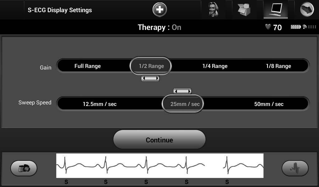Nastavení měřítka S-EKG K úpravě amplitudy S-EKG v reálném čase a pro zobrazení možností nastavení rychlosti posunu: 1.