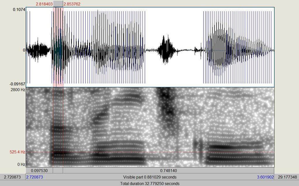 1. Úvod a bradykineze v průběhu léčby. [46] Proto může hodnocení artikulace přinést objektivní informaci o účincích léčby. 1.4. Ruční analýza formantových frekvencí Hodnocení poruch artikulace samohlásek probíhá tradičně ruční analýzou formantových frekvencí (viz např.