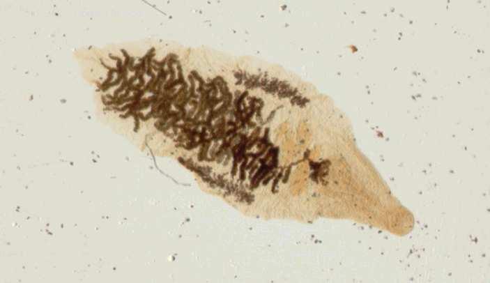 Trematoda (motolice) Schistosoma hematobium (krevnička močová) onemocnění bilharcióza (urogenitální systém člověka) Středomoří a tropy Afriky a Asie Dicrocelium dendriticum (motolice kopinatá) MZH :