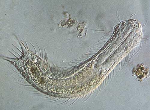 Kmen: Gastrotricha - břichobrvky moře, sladká