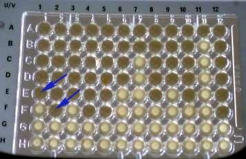 http://mikrobiologie.lf3.cuni.cz/rep/mic.htm METODY DETEKCE FENOTYPOVÉ (KULTIVAČNÍ) 3.