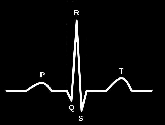 Obr. 2.1: Typický průběh EKG křivky Pro zpracování signálu EKG mohou být důležité také jeho spektrální vlastnosti znázorněné na Obr. 2.2. Převážná část energie komplexu QRS je v pásmu přibližně mezi 5 a 20 Hz s maximem mezi 10 a 15 Hz.