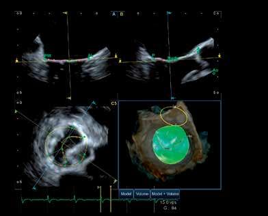 K dispozici je celá řada pokročilých vyhodnocovacích nástrojů, které umožňují detailně vyhodnotit anatomii a funkci srdce.