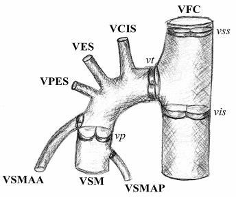 Confluens venosus subinguinalis klinicky Crosse = terminální