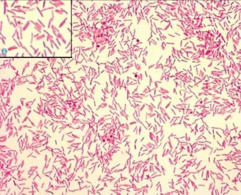 Capnocytophaga canimorsus G- nesporulující, fakultativně anerobní tyčka běžná komensální flora v dutině ústní psů a dalších savců (koček) virulence nízká, rizikové skupiny imunokompromitovaní,