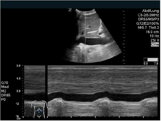 Tekutiny IVC 30