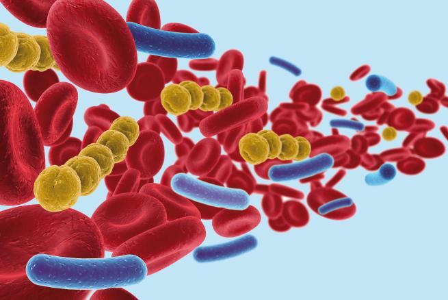 Presepsin Colours of sepsis