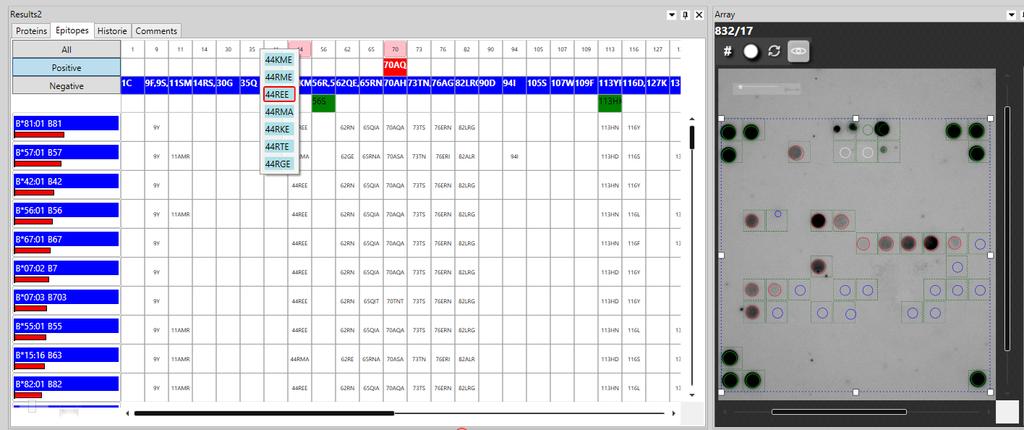 Kliknutím pravým tlačítkem myši na poziční číslo v horní části sloupce tabulky se zobrazí epitopy pro tuto pozici. Ty, které jsou orámovány červeně jsou určeny softwarem jako pozitivní.