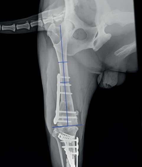 kulhání I/VI. Jinak byl v pohybu bez omezení. RTG prokázalo přemostění obou osteotomií (obr. 15 a 16).