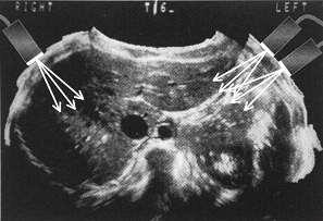 Extended FOV imaging ultrazvuk v medicíně 1950 20/21 století - kontrastní látky - nové modality (harmonický UZ) - 3D, 4D -