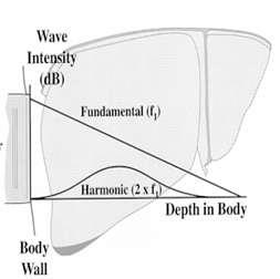 Tzv. vyšší harmonické frekvence vznikají ve tkáních, které jsou vystaveny ultrazvukovému vlnění, přirozeně - v důsledku nelineárního šíření ultrazvukového budícího impulsu. Tzv.