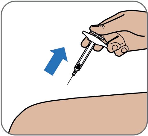 Krok 6: Když je injekční stříkačka prázdná, vytáhněte jehlu z kůže a držte jehlu stále pod stejným úhlem jako při vpichu. Nikdy znovu nezakrývejte jehlu krytem.