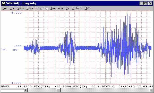 Elektrické biosignály EMG název zdroj elektrody rozsahy