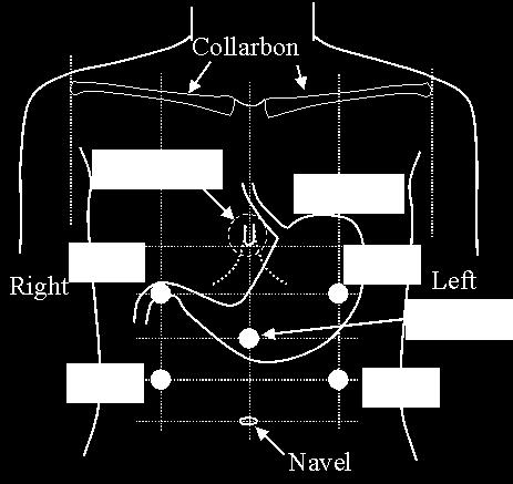 elektrogastrogram EGG potenciály