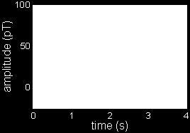 70 0,05 150 MEG magnetoencefalogram 1 2 0,5 30 MMG