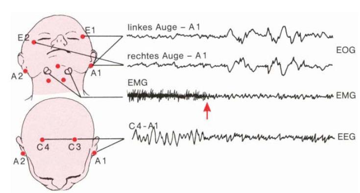 Polysomnografie EEG min.