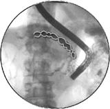 0 l/den 55 56 SPECIFICKÁ STIMULACE ORMONY SEKRETIN COLECYSTOKININ, = PANKREOZYMIN CRONICKÁ PANKREATITÍDA ZOBRAZOVACÍ METODY ERCP ŠŇŮRA PEREL ANALÝZA BIKARBONÁTŮ ANALÝZA AMYLÁZY