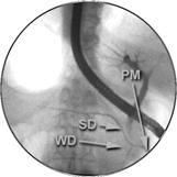 SANTORINI 58 Erchinger F, Engjom T, Gudbrandsen OA et al.: Automated spectrophotometric bicarbonate analysis in duodenal juice compared to the back titration method. Pancreatology.