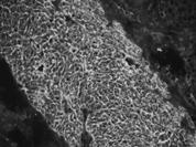 2012; 171(7) : 1011-1021 68 Old and new serological tests for celiac disease screening. Volta U.