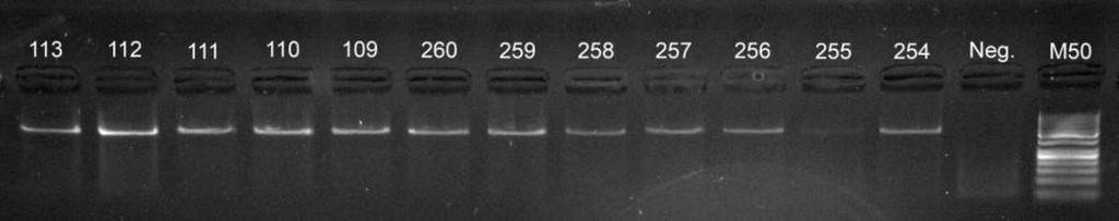 5 VÝSLEDKY A DISKUZE 5.1 PCR RFLP Metoda PCR byla použita pro amplifikaci úseků genu TG o velikosti 545 bp (viz obr. 7). Metodika reakce byla převzata od původních autorů.