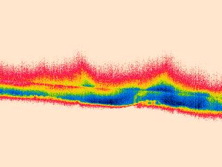 4.4 Využití infračervené termografie v radonové diagnostice Princip tohoto nového postupu radonové diagnostiky je založen na termografickém snímání (nekontaktním stanovení teploty snímaných povrchů)