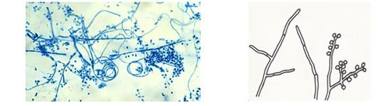 Obr. 4 Trichophyton mentagrophytes var. quinckeanum Převzato z: http://www.