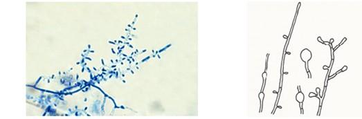 Obr. 7 Trichophyton tonsurans Převzato z: