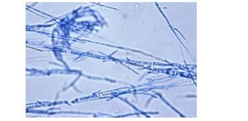 Obr. 9 Trichophyton soudanense Převzato z: