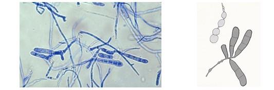 Epidermophyton floccosum Převzato z: au/;