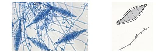 Obr. 13 Microsporum canis Převzato z: