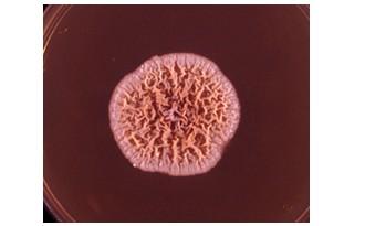 Obr. 21 Trichophyton violaceum Převzato z: http://www.mycology.adelaide.edu.au/ Obr.