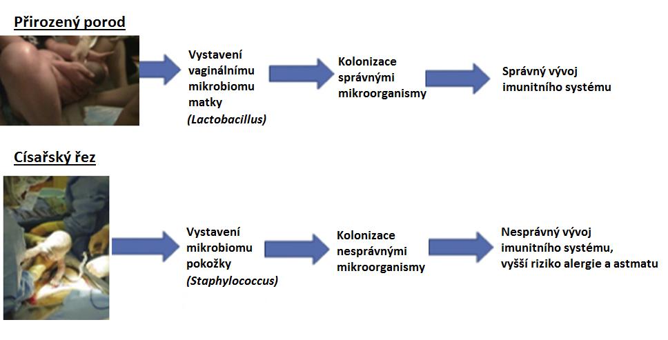 Obr. 3 Rozdíly v bakteriální kolonizaci podle způsobu porodu (Neu J. a kol. 2011, upraveno). Při přirozeném porodu je dítě vystaveno vaginálnímu, ale také fekálnímu mikrobiomu matky.