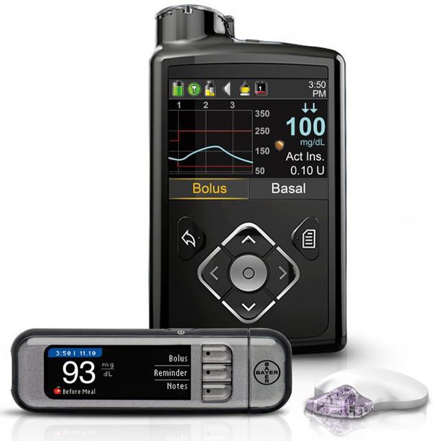 Medtronic Minimed 670G Hybridní uzavřená smyčka Schváleno FDA v září 2016 Algoritmus SmartGuard HCL pro dávkování insulinu Automaticky reguluje basální dávku