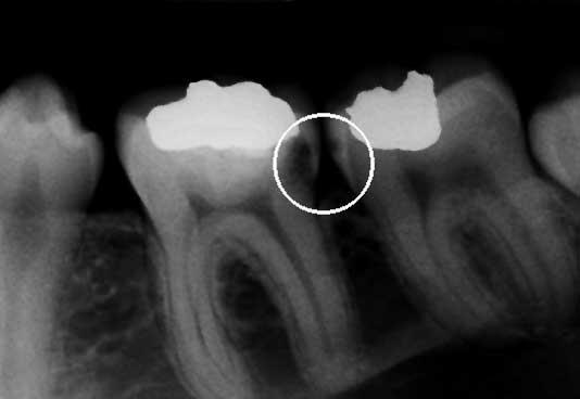 Diagnostika ve stomatologické rentgenologii umožňuje souhrnný pohled na rozdílné anomálie, tvarové odlišnosti a regresivně probíhající změny zubů, které se mohou v zubním lékařství vyskytnout.