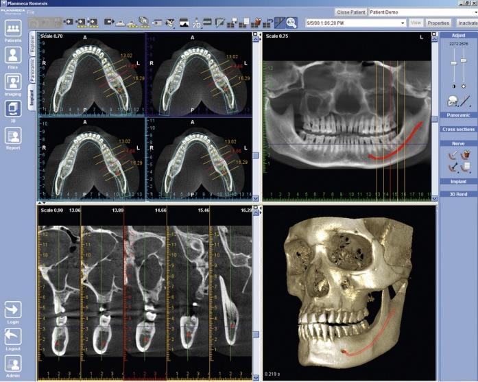 záření dochází k získání obrazových dat z celé plochy snímané oblasti, takže každý jednotlivý snímek zachytí všechny detaily. Náš dentální trh nabízí celou řadu zařízení určených k tzv.