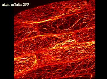 Mikrofilamenta 2 aktinová vlákna, 8nm Žárský,