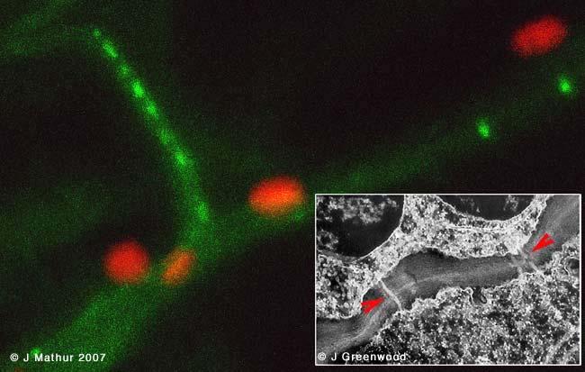 Plasmodesmata [30] are channels in the plant cell wall ( See Figure above: Green fluorescent punctae and the red arrowheads pointers on the TEM inset ) that in conjunction with