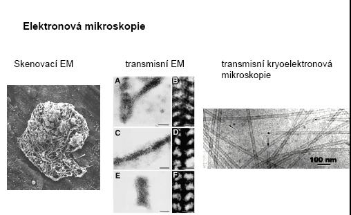 Mikrofilamenta  