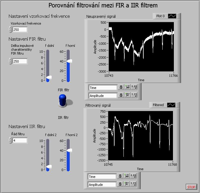 25 8.1.2 Program pro porovnání mezi FIR a IIR filtrem Tento program, jak již název napovídá, se zabývá porovnáním filtrování FIR a IIR filtru, oba tyto filtry jsou typu pásmová propust.