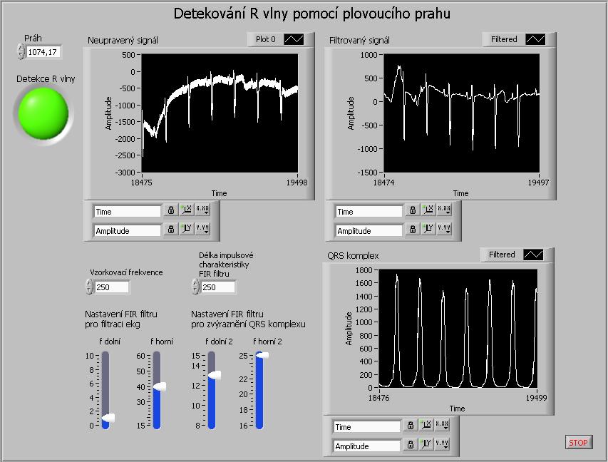 32 8.1.5 Program na detekování R vlny pomocí plovoucího prahu Tento program je upravenou verzí předešlého programu, liší se jiným přístupem k detekci R vlny.