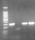 Výsledky PCR Mr 1. 2. 3. 4. Mr marker 100bp 1500 bp 1.