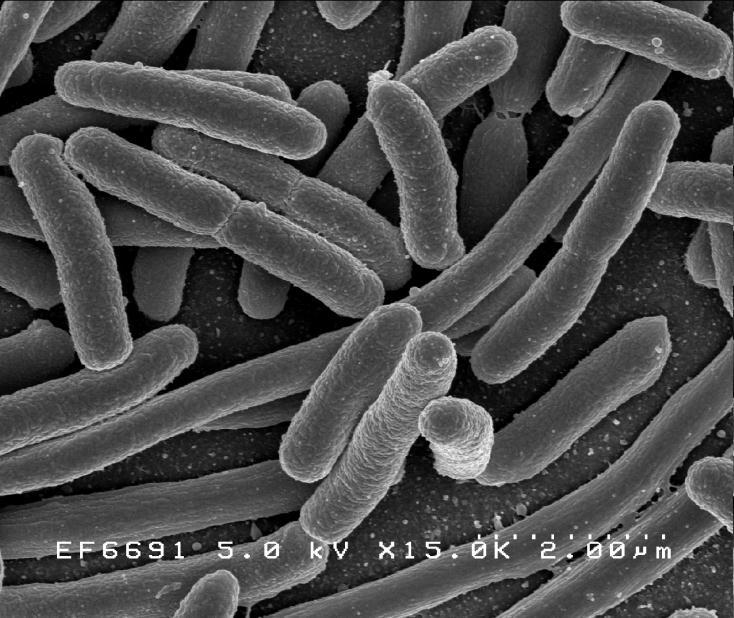 Escherichia coli Gramnegativní pohyblivá paličkovitá bakterie. Žije v tlustém střevu člověka a teplokrevných zvířat. Je komenzál (organismus žijící v hostiteli, aniž by mu způsoboval škodu).