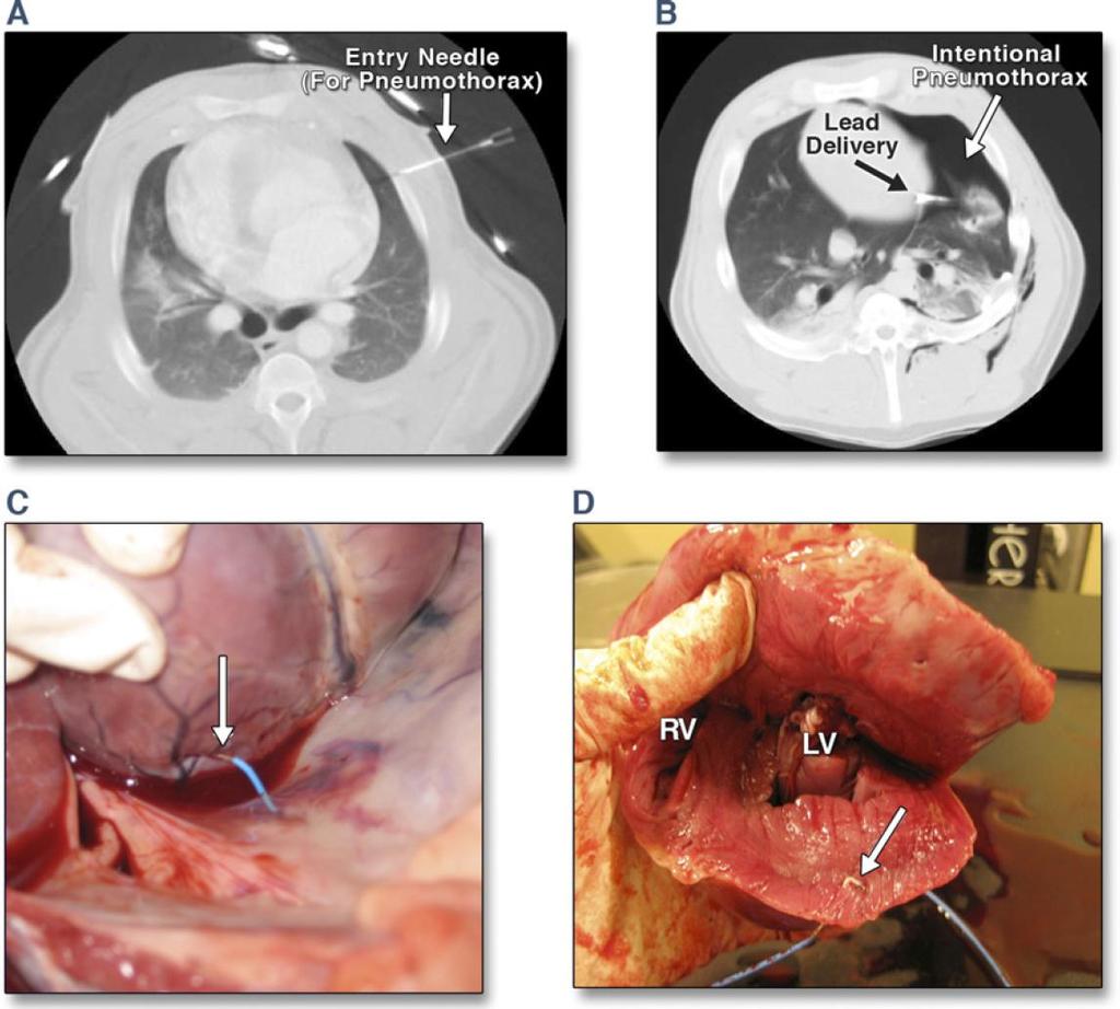 Dickfeld T: JACC