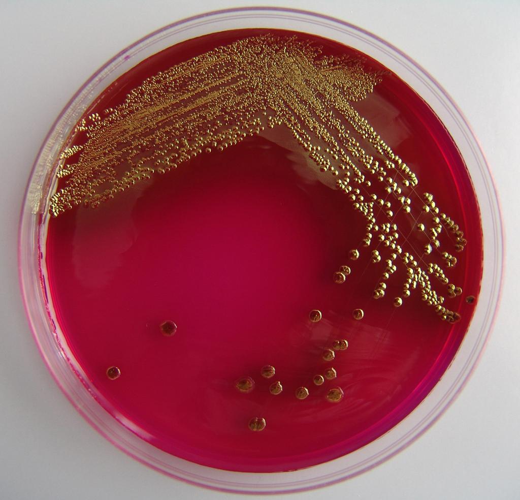 Původ a zdroj infekce se nepodařilo objasnit v květnu roku 2011 propukla v Německu v okolí Hamburku zatím největší epidemie vyvolaná EHEC/STEC v Evropě.